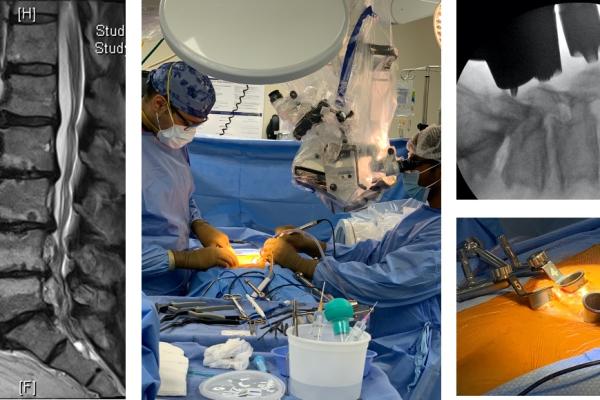 Benefits of Minimally Invasive Spine Surgery for Faster Recovery