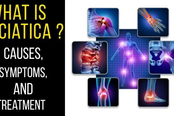 Sciatica Pain: Causes, Symptoms & Advanced Treatment Options
